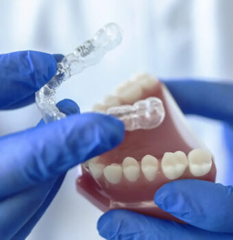 Corrige tus dientes con nuestros alineadores Clear Smile