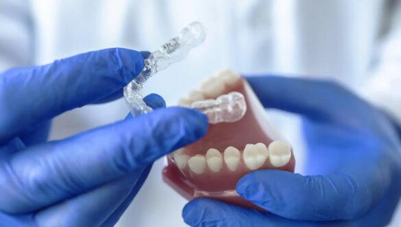 Corrige tus dientes con nuestros alineadores Clear Smile