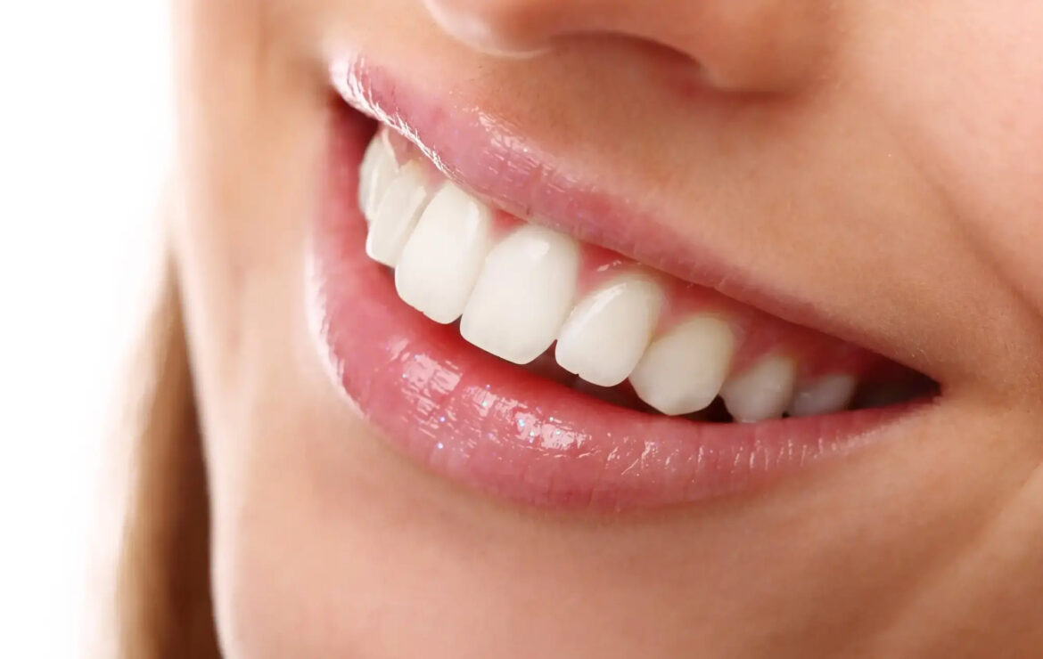 Tratamiento Clear Smile | Alineadores Transparentes