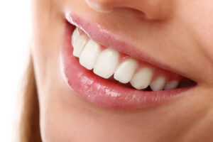 Tratamiento Clear Smile | Alineadores Transparentes