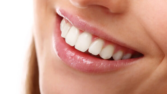 Tratamiento Clear Smile | Alineadores Transparentes