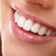 Tratamiento Clear Smile | Alineadores Transparentes